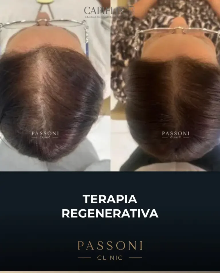 Passoni = antes e depois 2