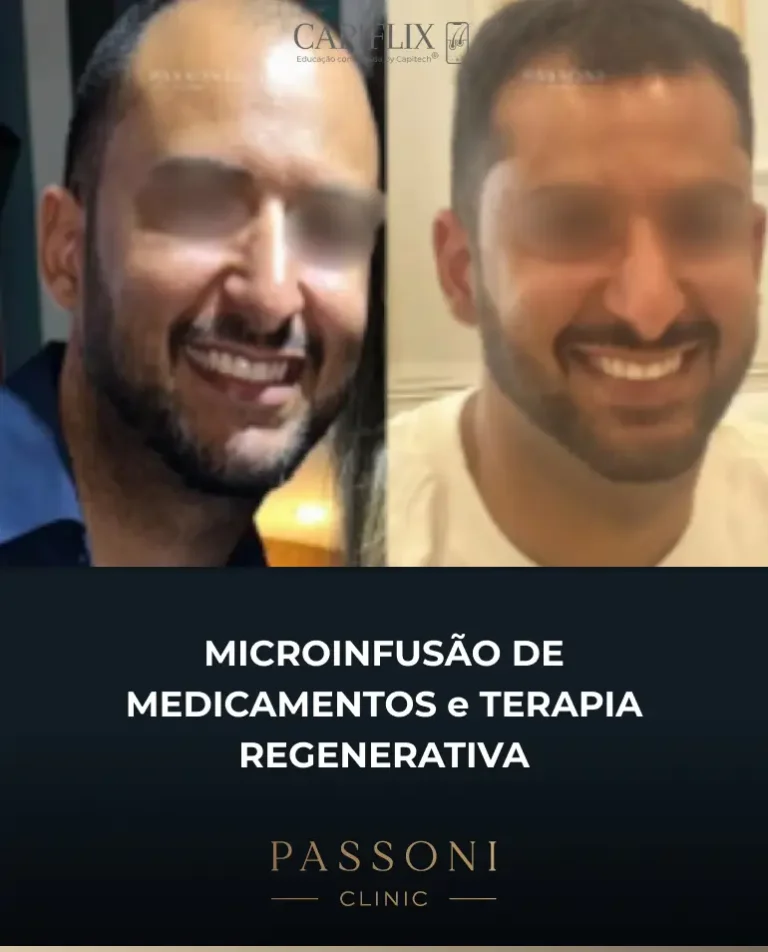 Passoni = antes e depois 22